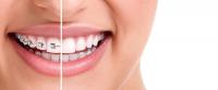 Ortodonti nedir?